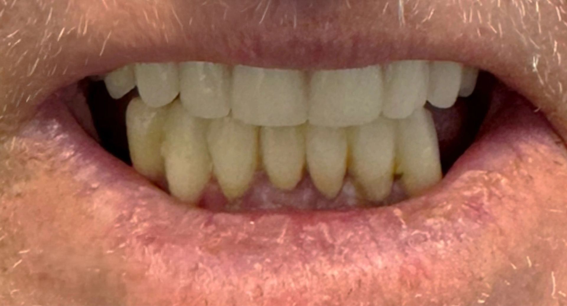 Angel Denture Clinic - Before and After Gallery