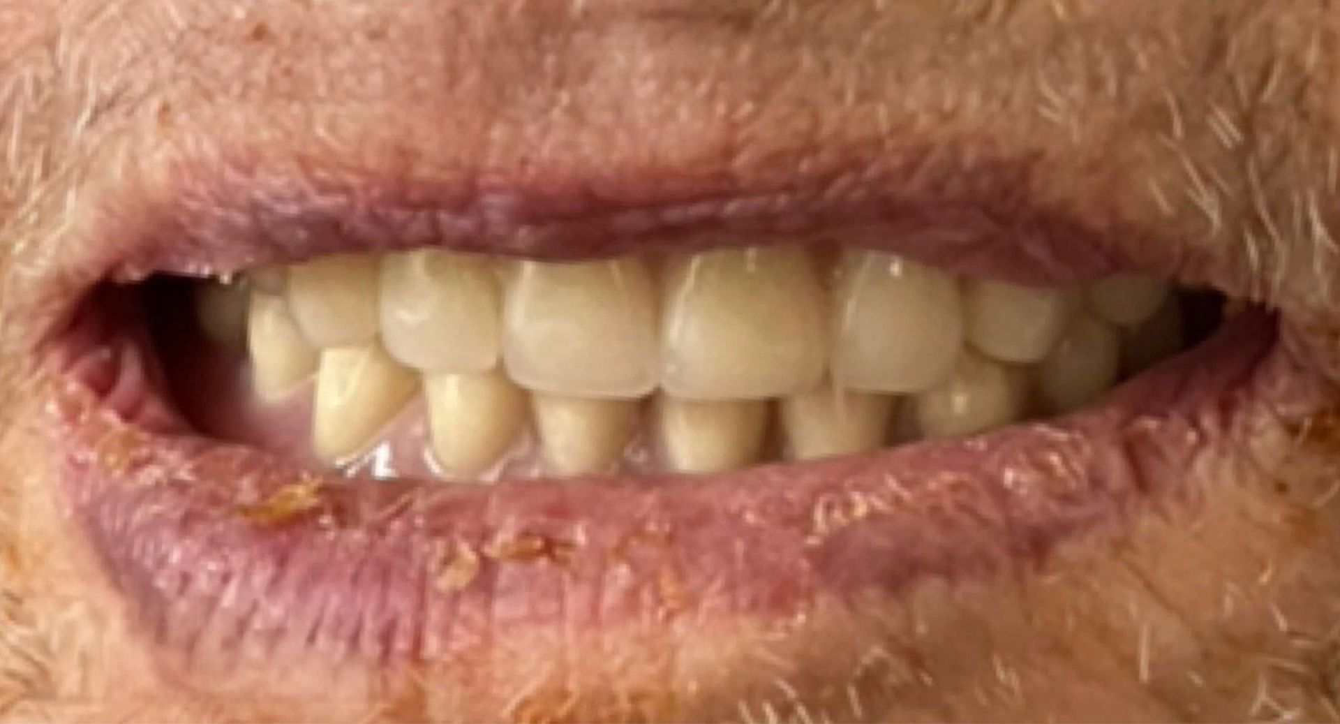 Angel Denture Clinic - Before and After Gallery