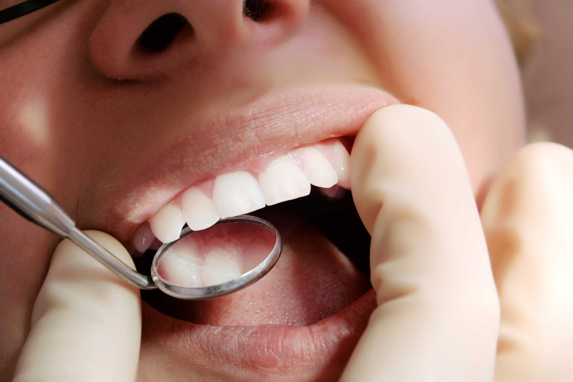 Adventure Smiles Dental & Orthodontics in Houston - A woman is getting her teeth examined by a dentist