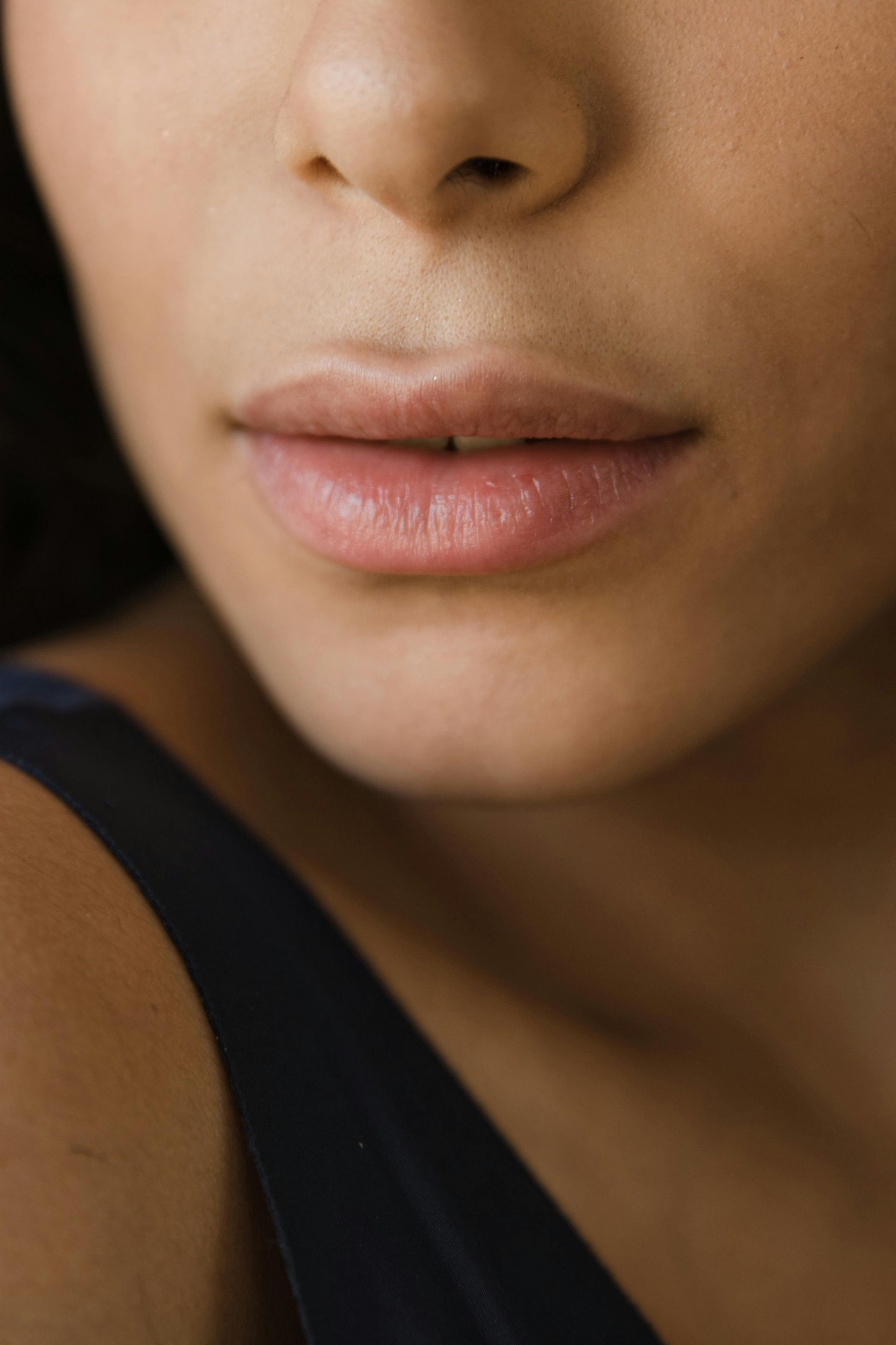 Close-up of a person's mouth and nose with a calm, neutral expression— Skin Haven Aesthetics Whitsundays in Airlie Beach, QLD
