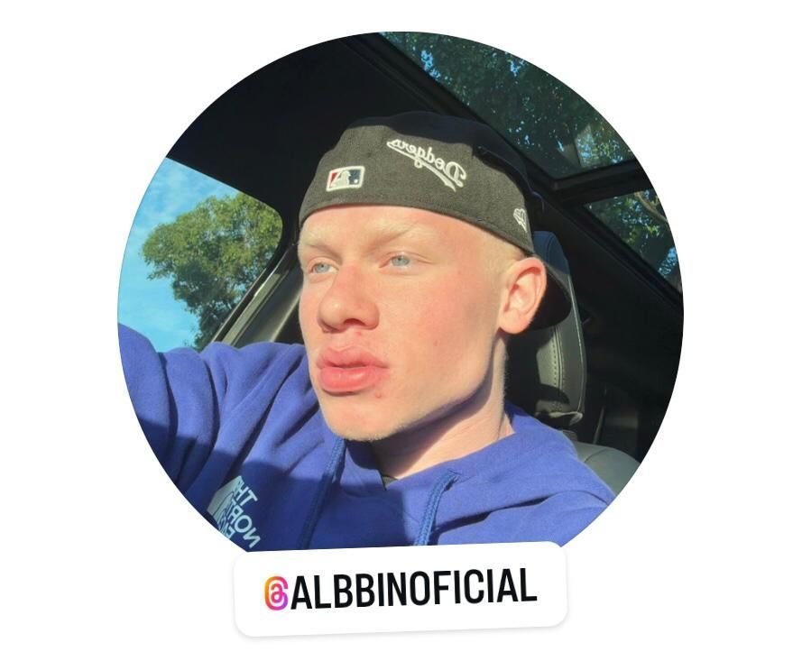 Albino Albinooficial