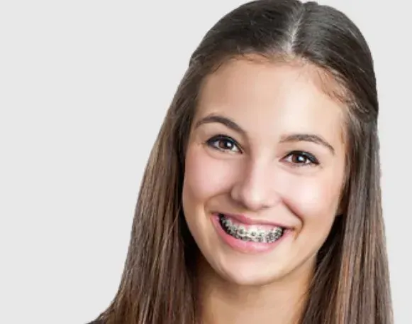 Smiling Person With Braces, Long Brown Hair, Looking at the Camera — Tamworth Orthocare In Tamworth, NSW
