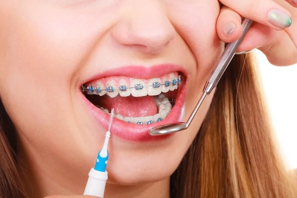 Woman With Braces Having Teeth Examined With Dental Tools — Tamworth Orthocare In Tamworth, NSW