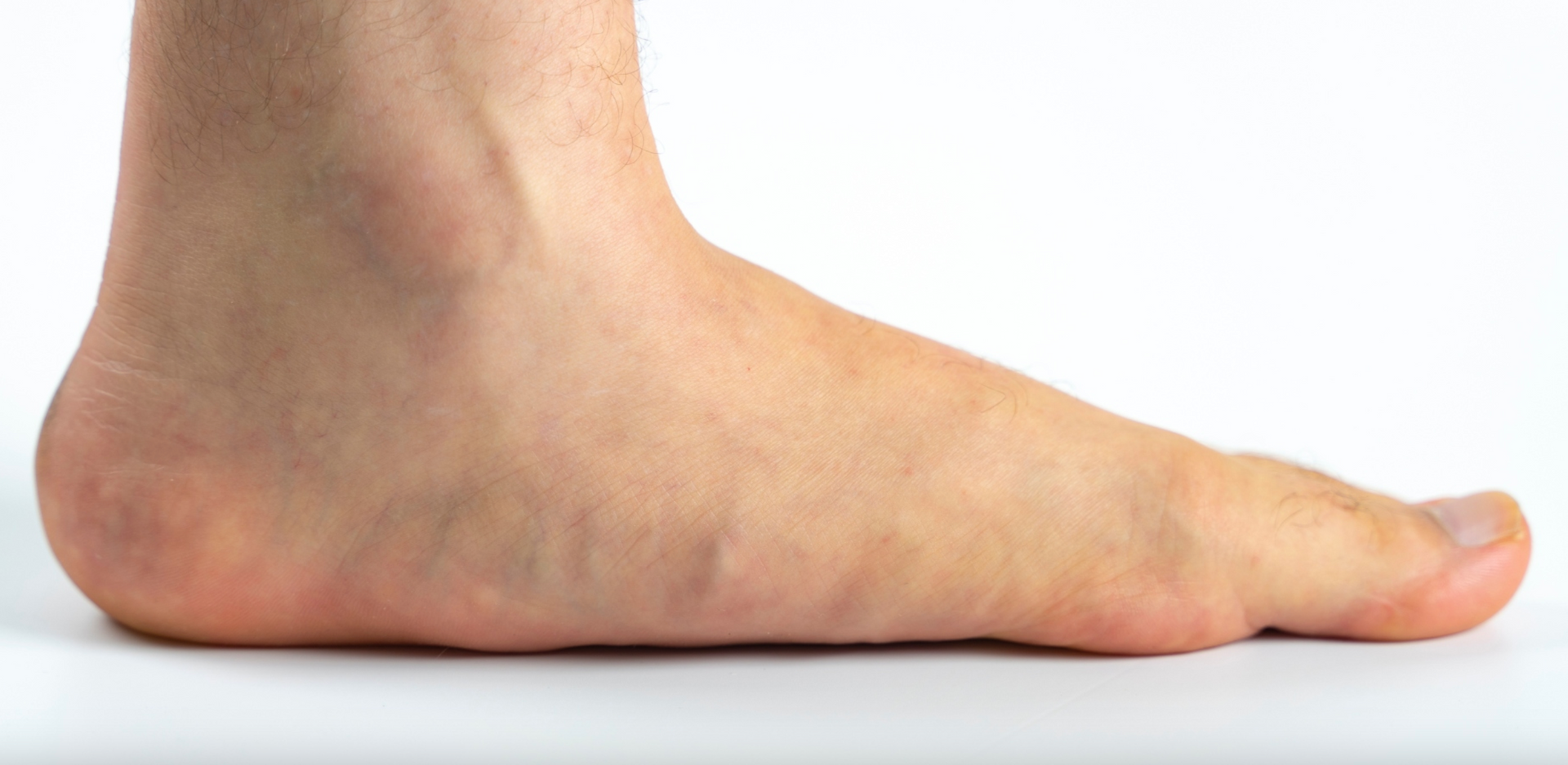 A close up of a person 's foot on a white surface.