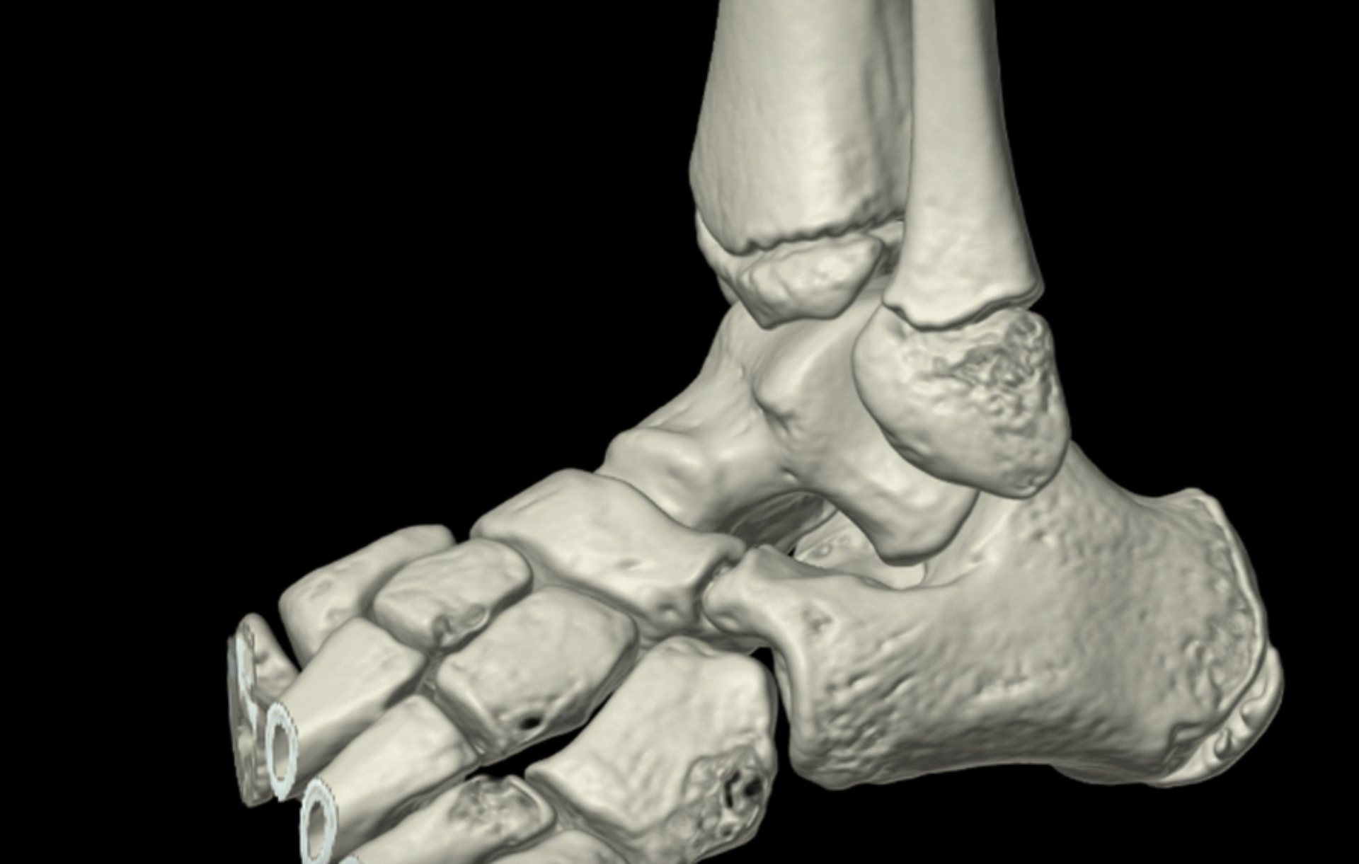 A close up of a skeleton of a foot on a black background.