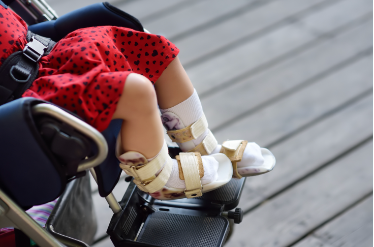 A little girl is sitting in a wheelchair with her legs crossed
