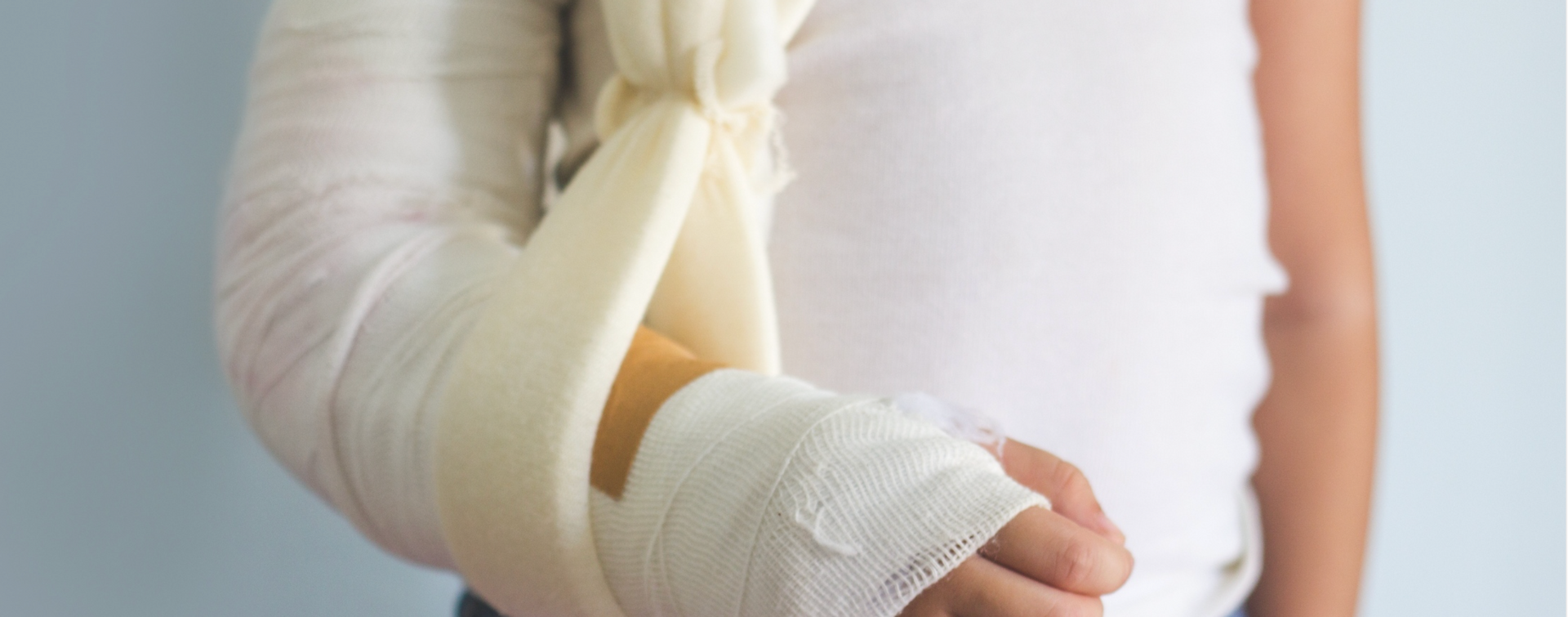 A person with a broken arm in a cast.