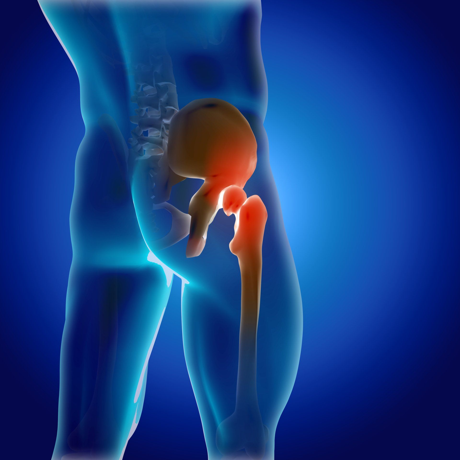 Hip Pain specialist