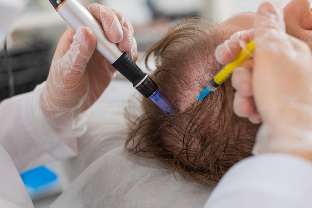 Medical Staff Examining a Patient’s Scalp — A9 Skin and Hair Clinic In Westmead, NSW