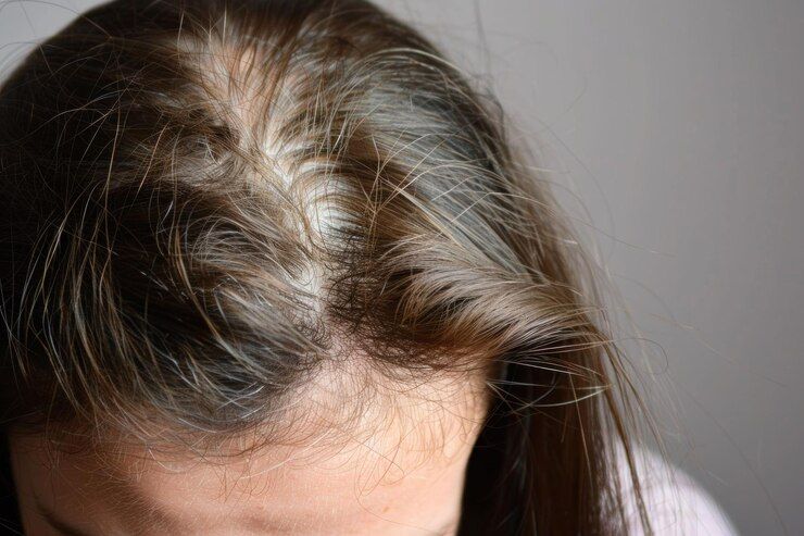 Top View of a Person’s Scalp With Thinning Hair — A9 Skin and Hair Clinic In Westmead, NSW