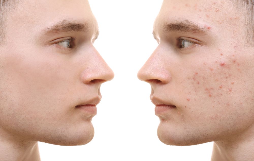 Two Side-profile Faces Facing Each Other — A9 Skin and Hair Clinic In Westmead, NSW