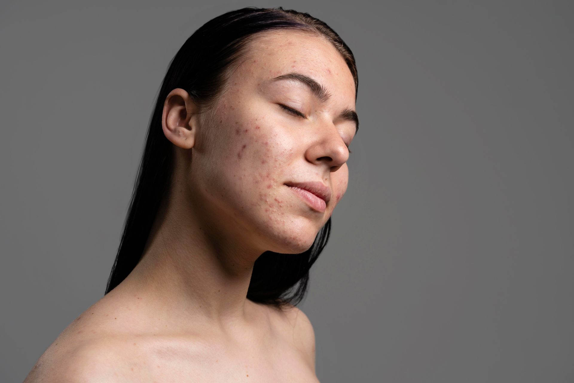 Portrait of a Person With Eyes Closed — A9 Skin and Hair Clinic in Westmead, NSW