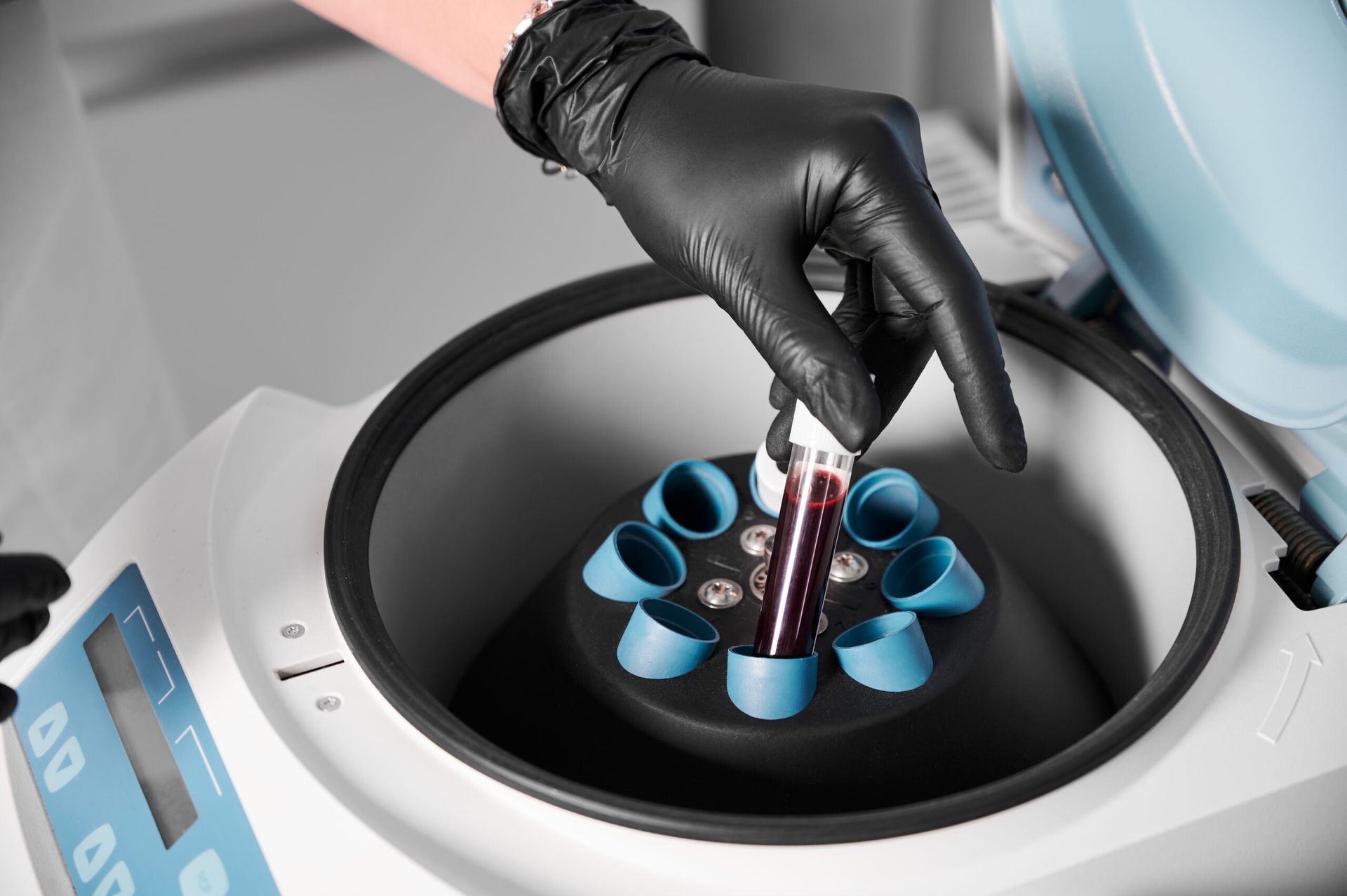 Gloved Hand Placing a Test Tube — A9 Skin and Hair Clinic in Westmead, NSW