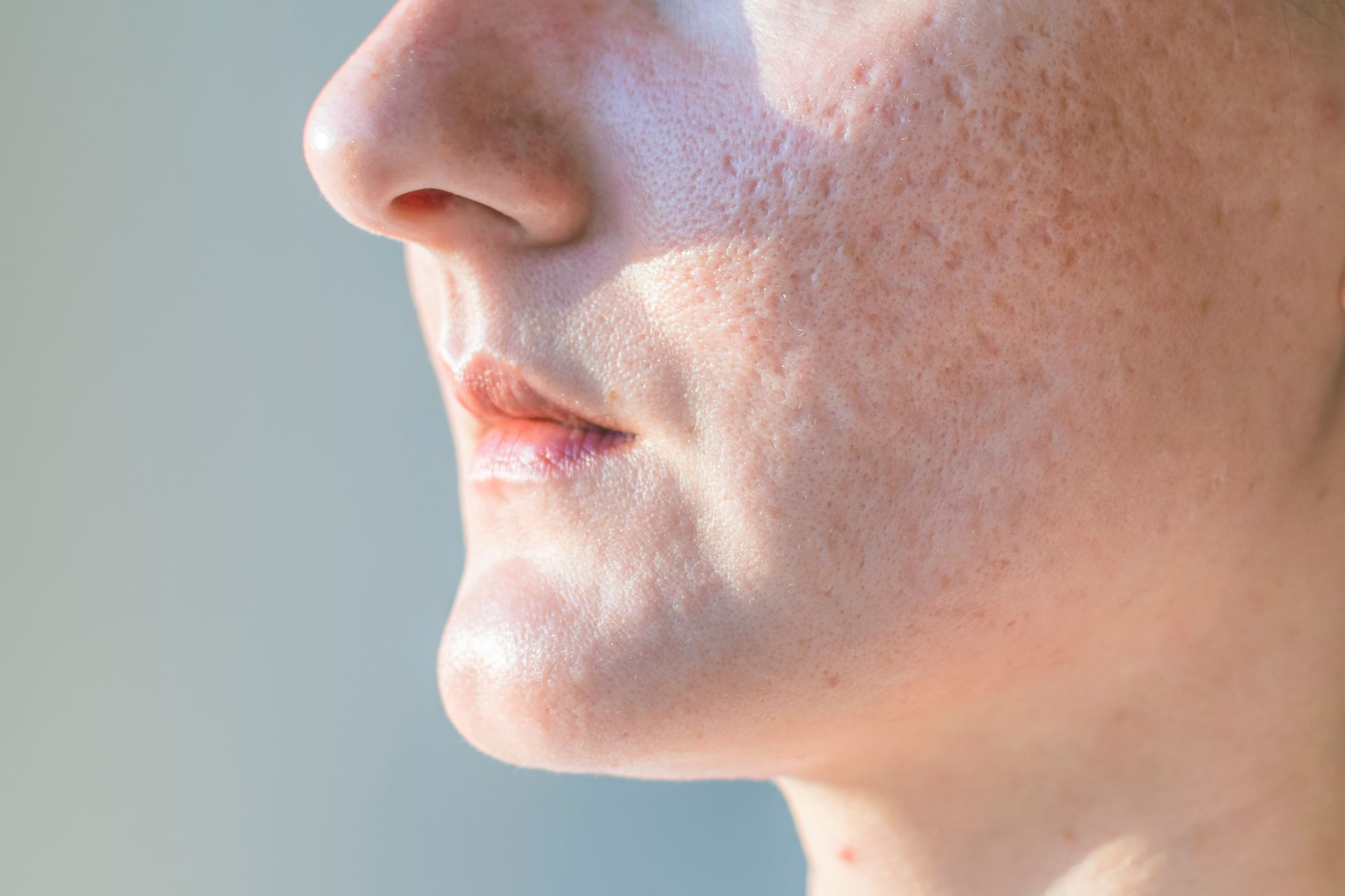Close-up Profile of a Person's Nose and Mouth — A9 Skin and Hair Clinic In Westmead, NSW