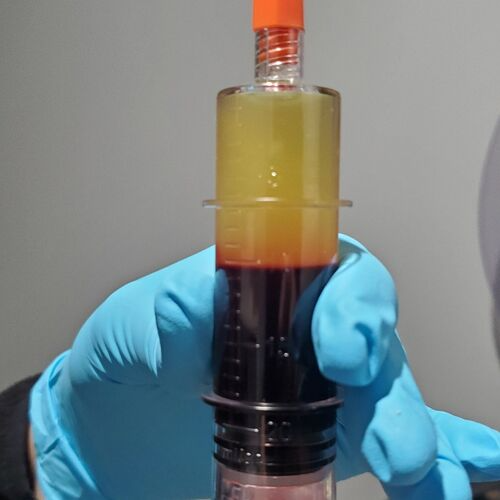 Platelet Rich Plasma Platelet Rich Plasma of ERA Wellness Spa in Georgetown, KY