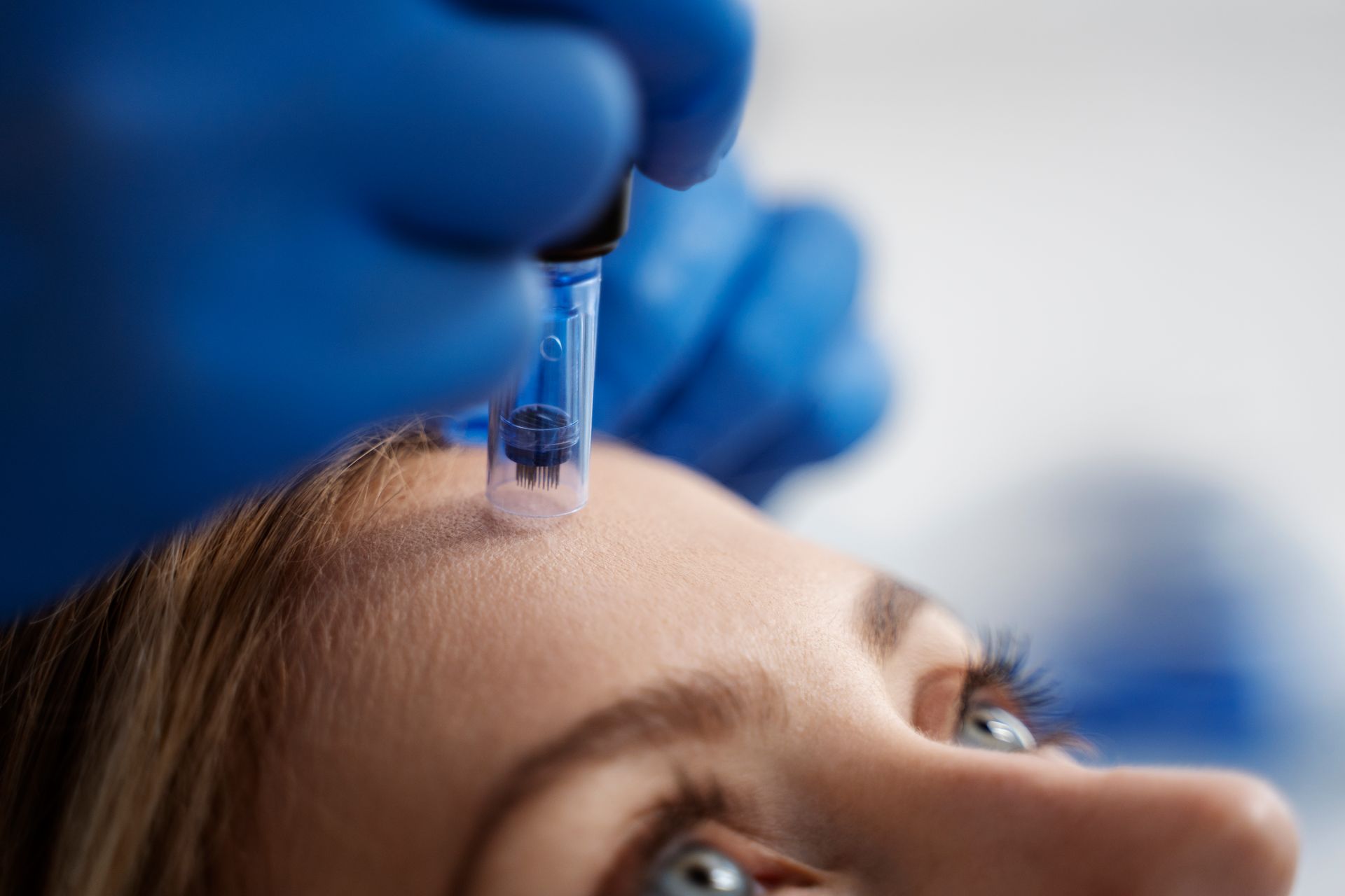 Microneedling service being performed at ERA Wellness Spa in Georgetown, KY