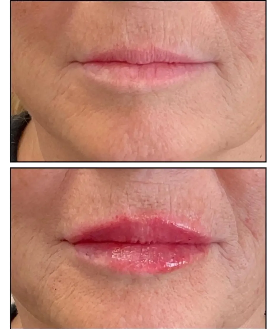 Two close-up lip images: natural pink lips above, glossy red lips below.