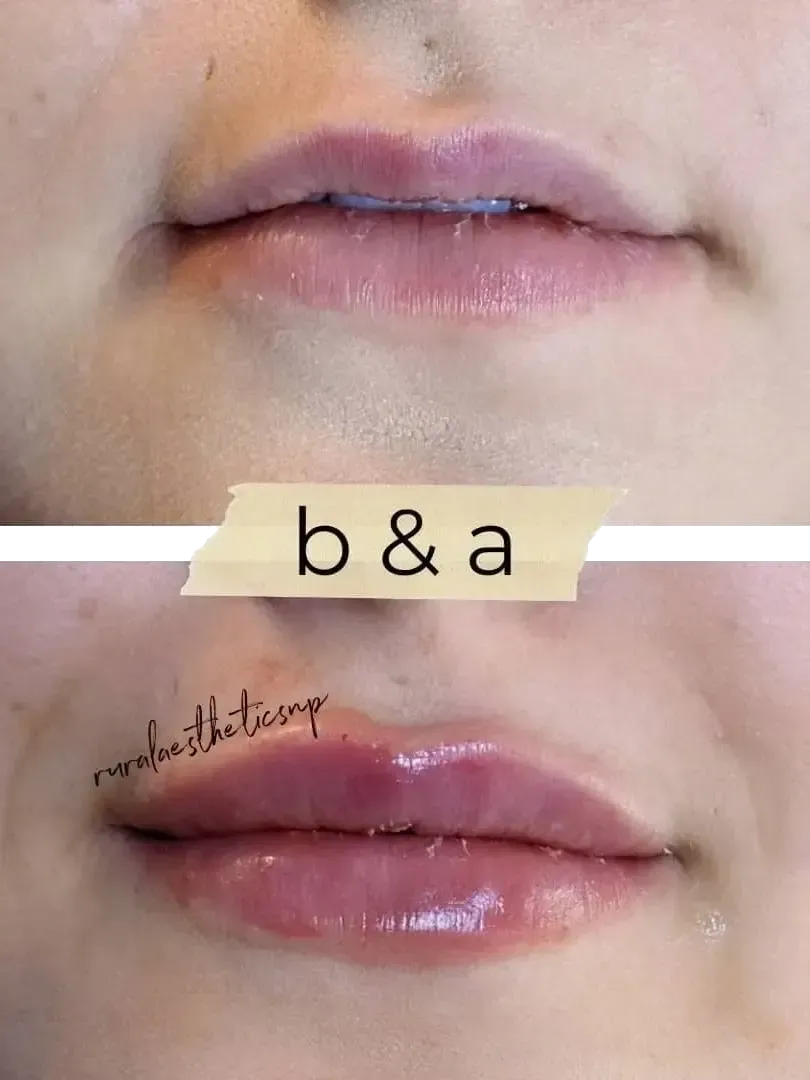 Close-up of glossy pink lips before and after lip tint, labeled “b&a”