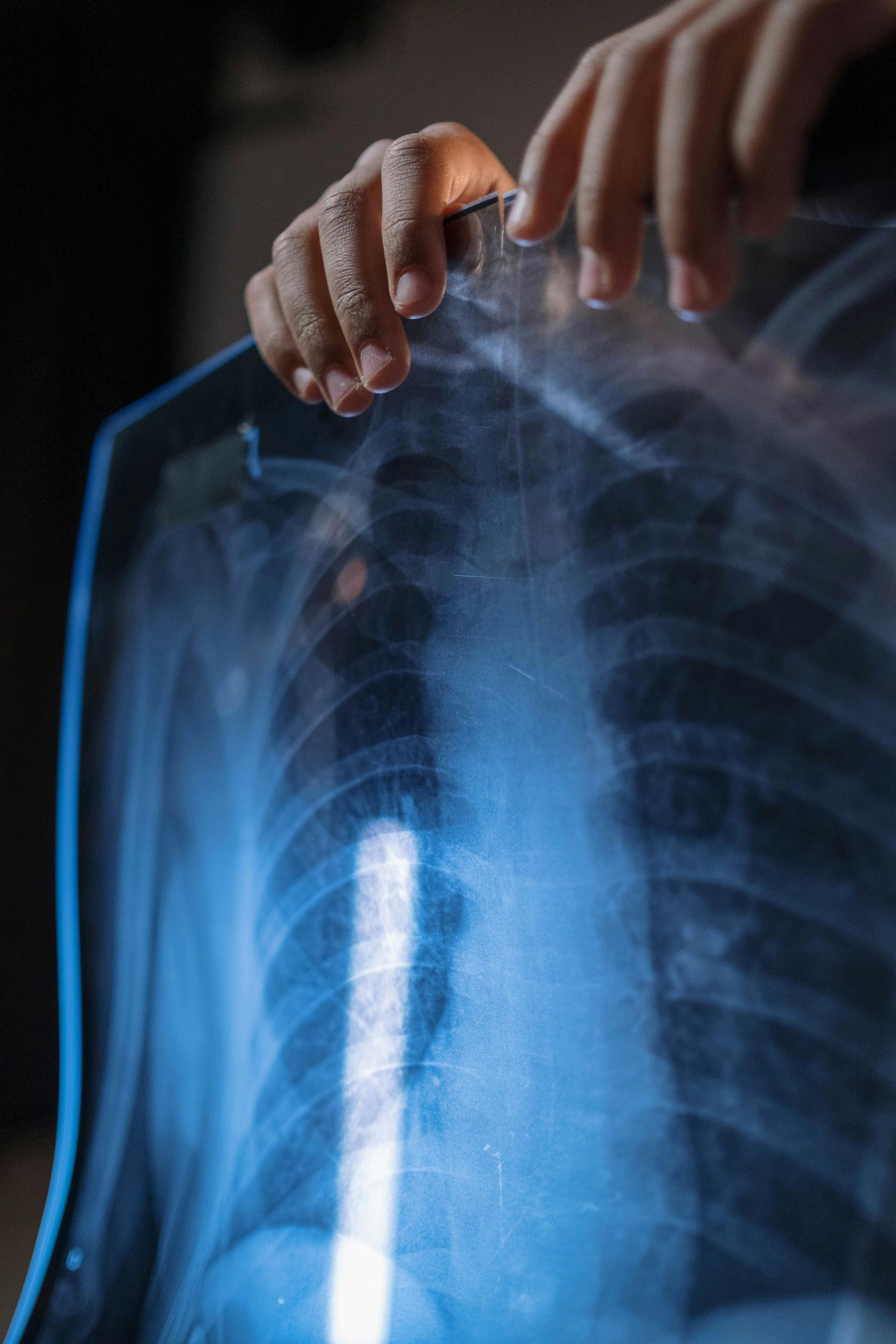 x-ray