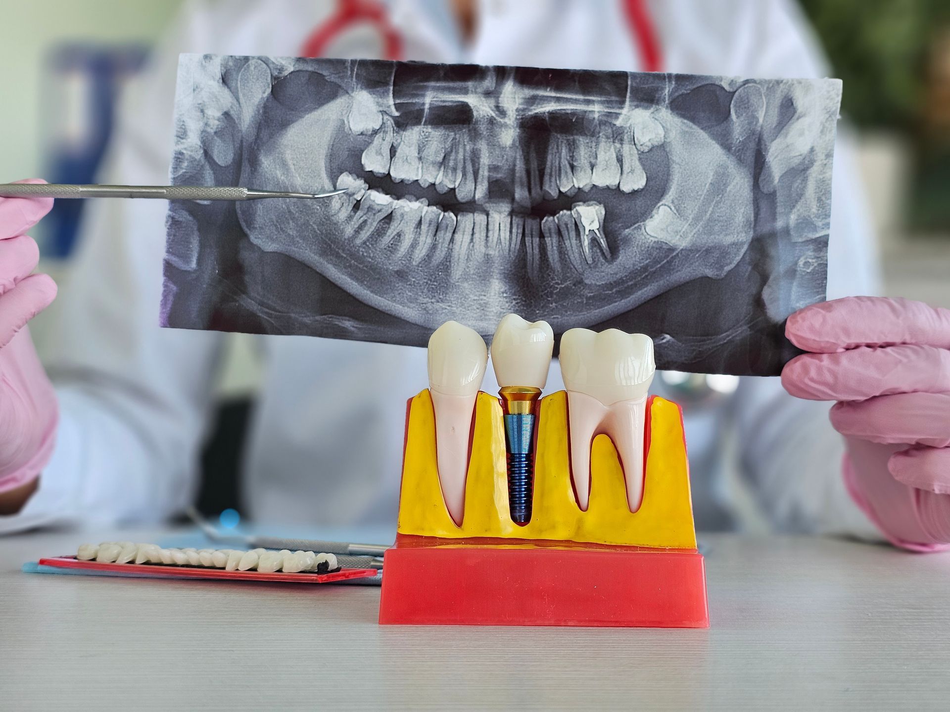 Person holding dental X-ray behind a model of teeth and gums on a table