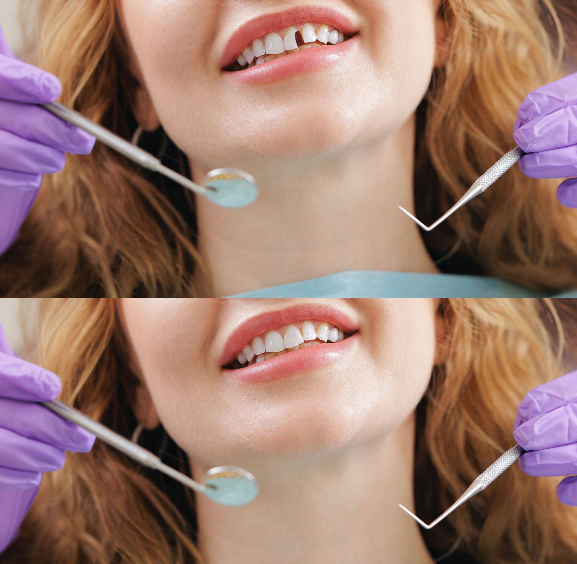 Dentist examining a patient’s mouth with gloved hands and dental tools, shown in two stacked close-ups