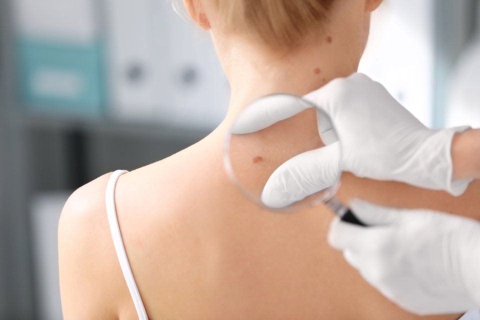 dermatologo analizza con lente pelle paziente donna