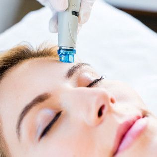 Hydrafacial Session on Woman's Face Hydrafacial Session on Woman's Face