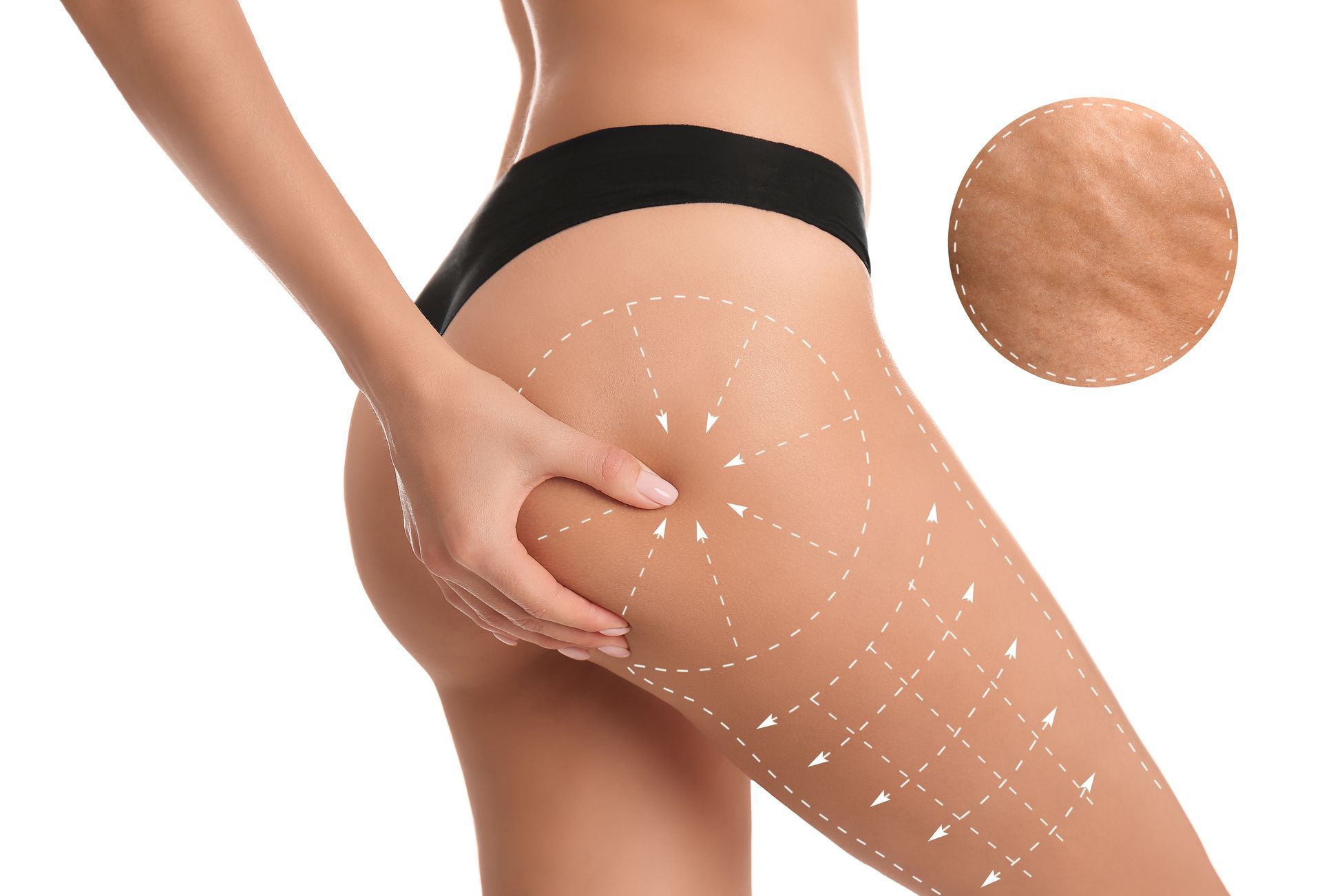 Person in black underwear pinching thigh skin, with dotted overlay and inset close-up of smooth skin texture