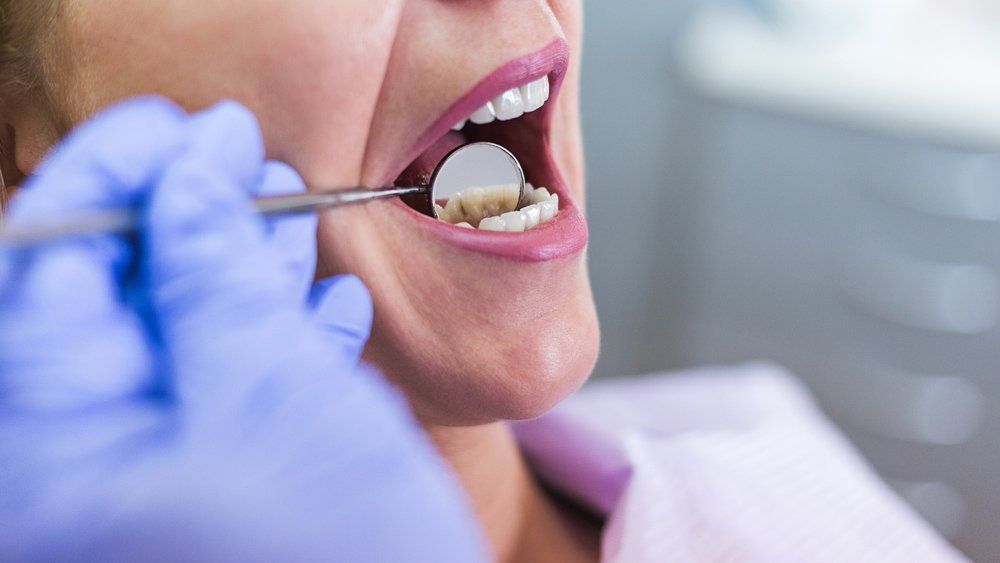 Open Mouth During Dental Checkup — Lenoir, NC — Wayne Hollar DDS Open Mouth During Dental Checkup — Lenoir, NC — Wayne Hollar DDS