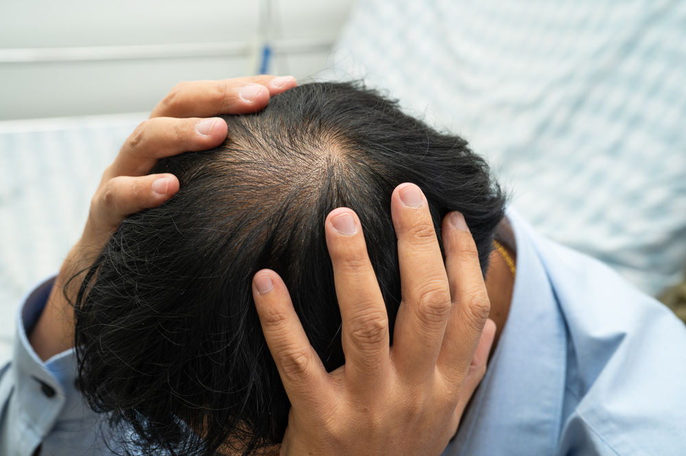 A man is holding his head with his hands.