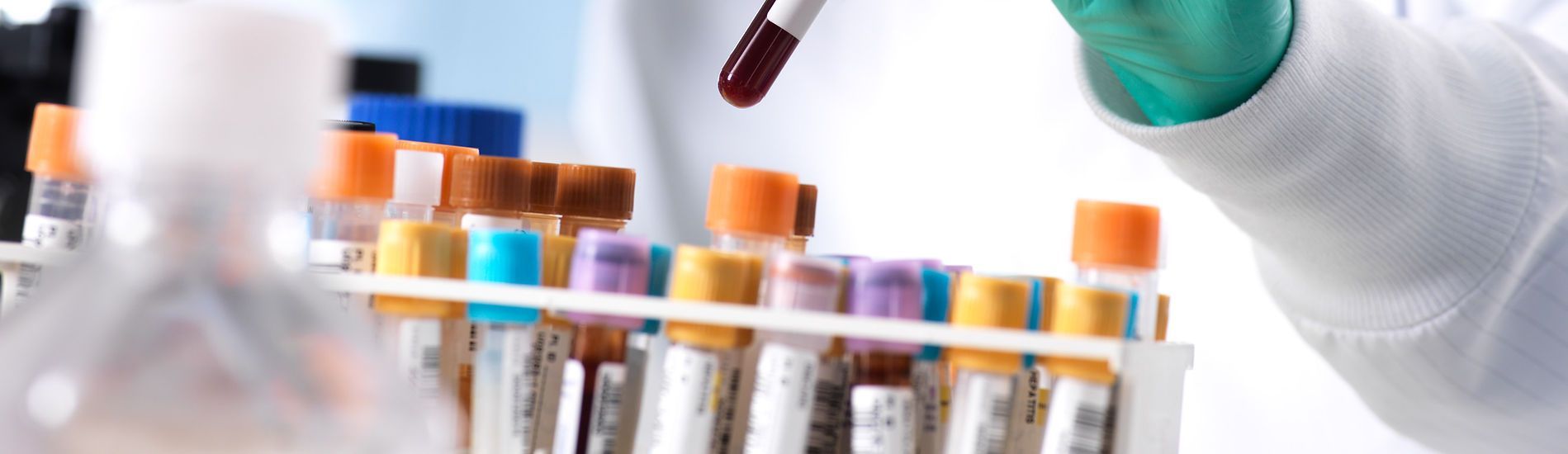 Blood Testing