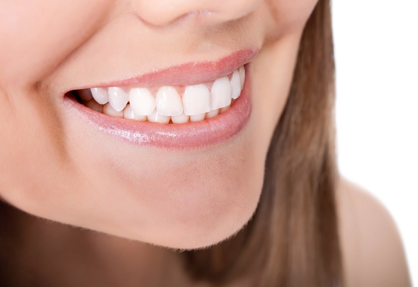 How to Prepare for an InOffice Teeth Whitening Session