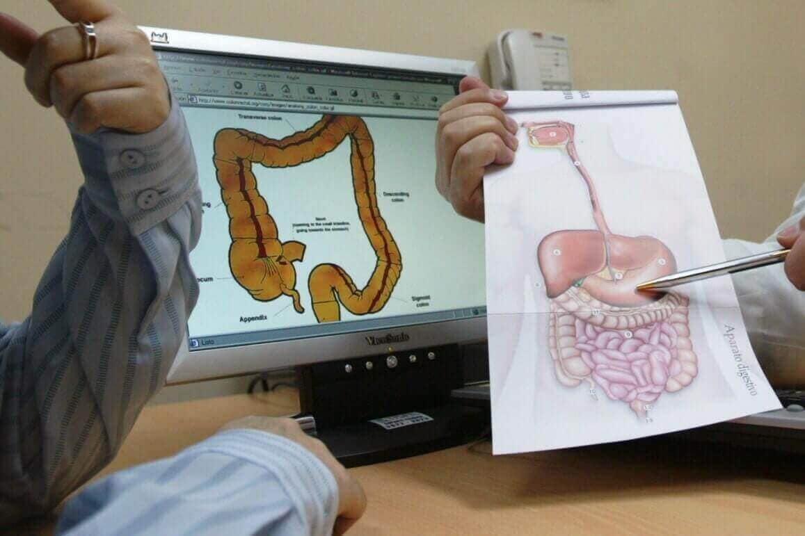 DR. MARCO VINICIO PEREZ MARISCAL - enfermedades anales