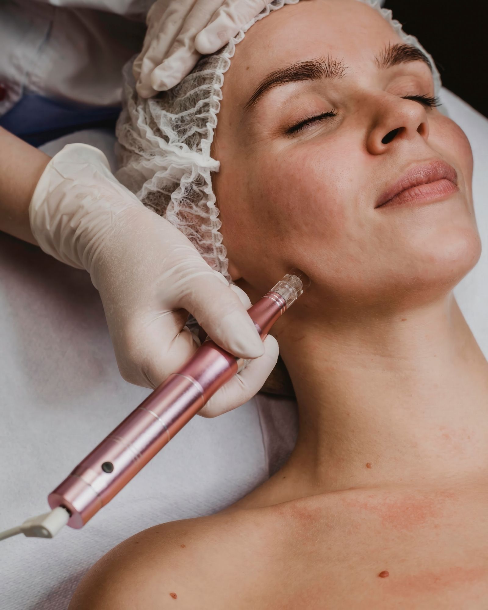 Soin HydraFacial Signature chez Medisthética