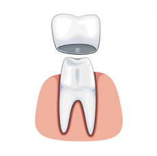 A tooth with a crown on top of it.