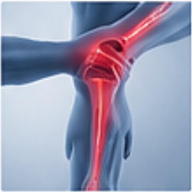 A glowing red elbow joint in a blue 3D human arm, showing pain or inflammation