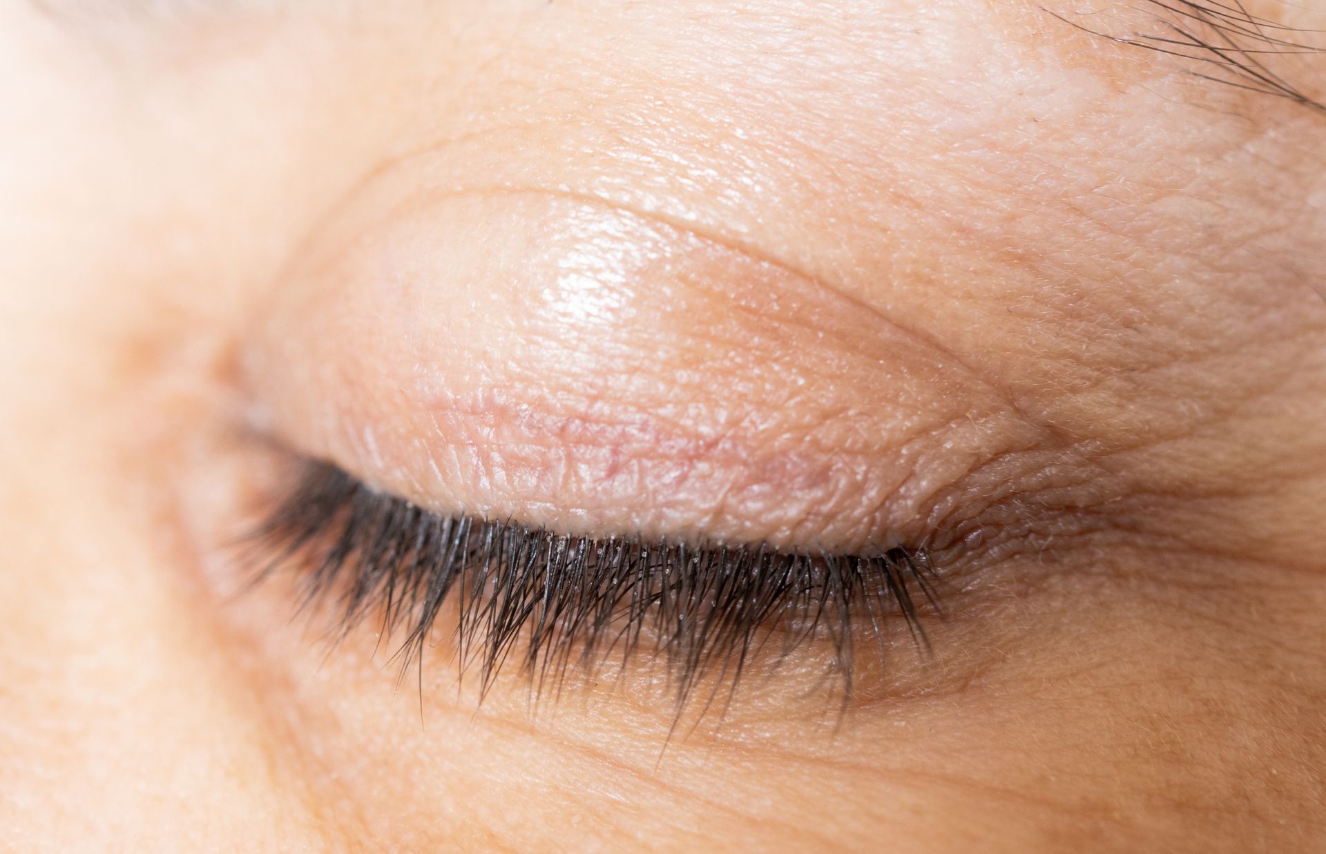 human eye lash line