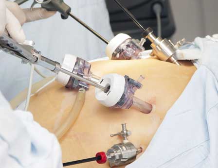 DR. FELIPE DE JESÚS GONZÁLEZ ARGÜELLES - cirugías laparoscópicas