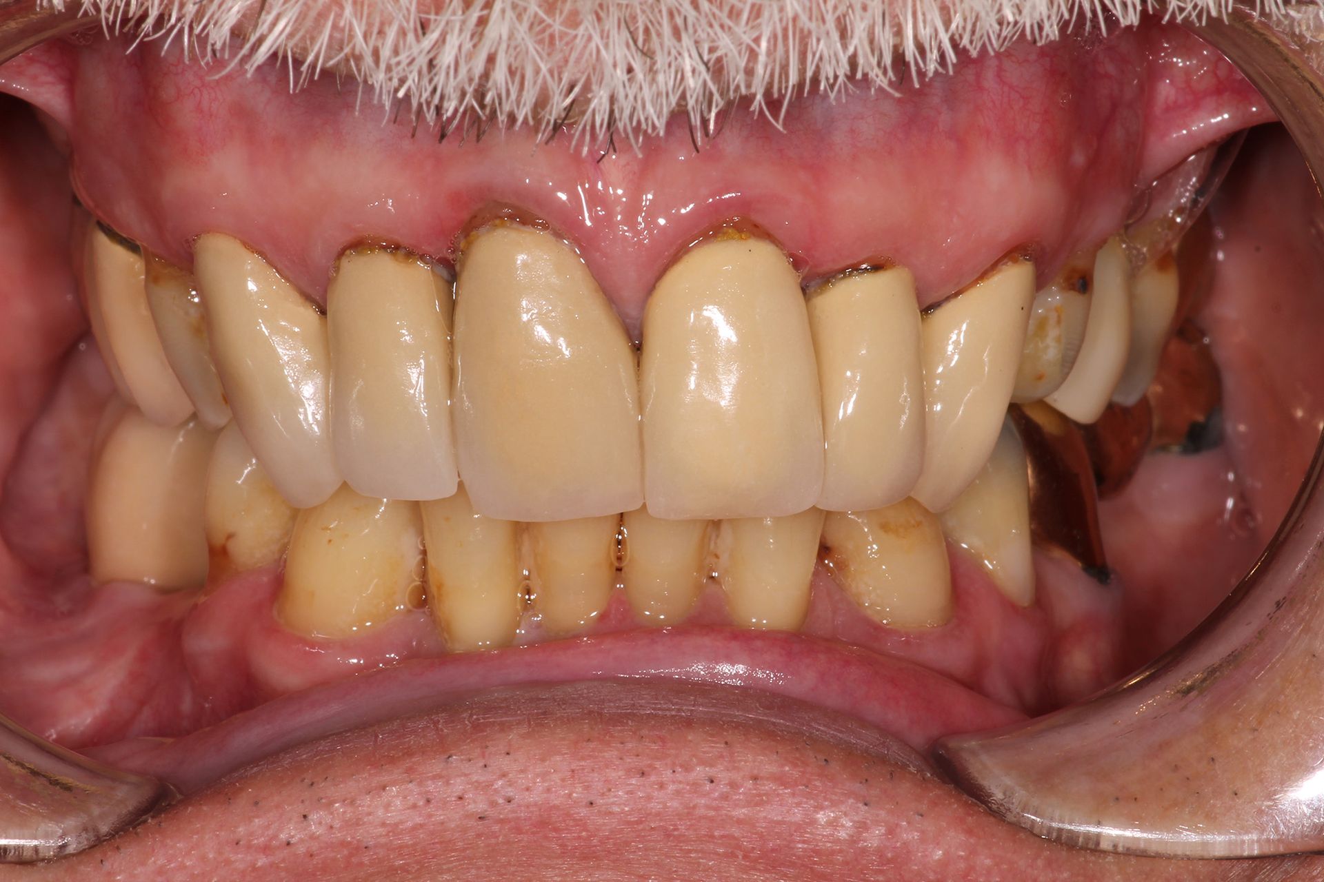 Bay View Dental Lab Chesapeake, VA