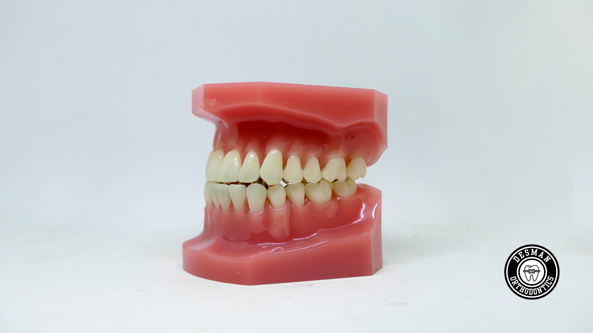 Pink dental model with open mouth showing teeth, side view