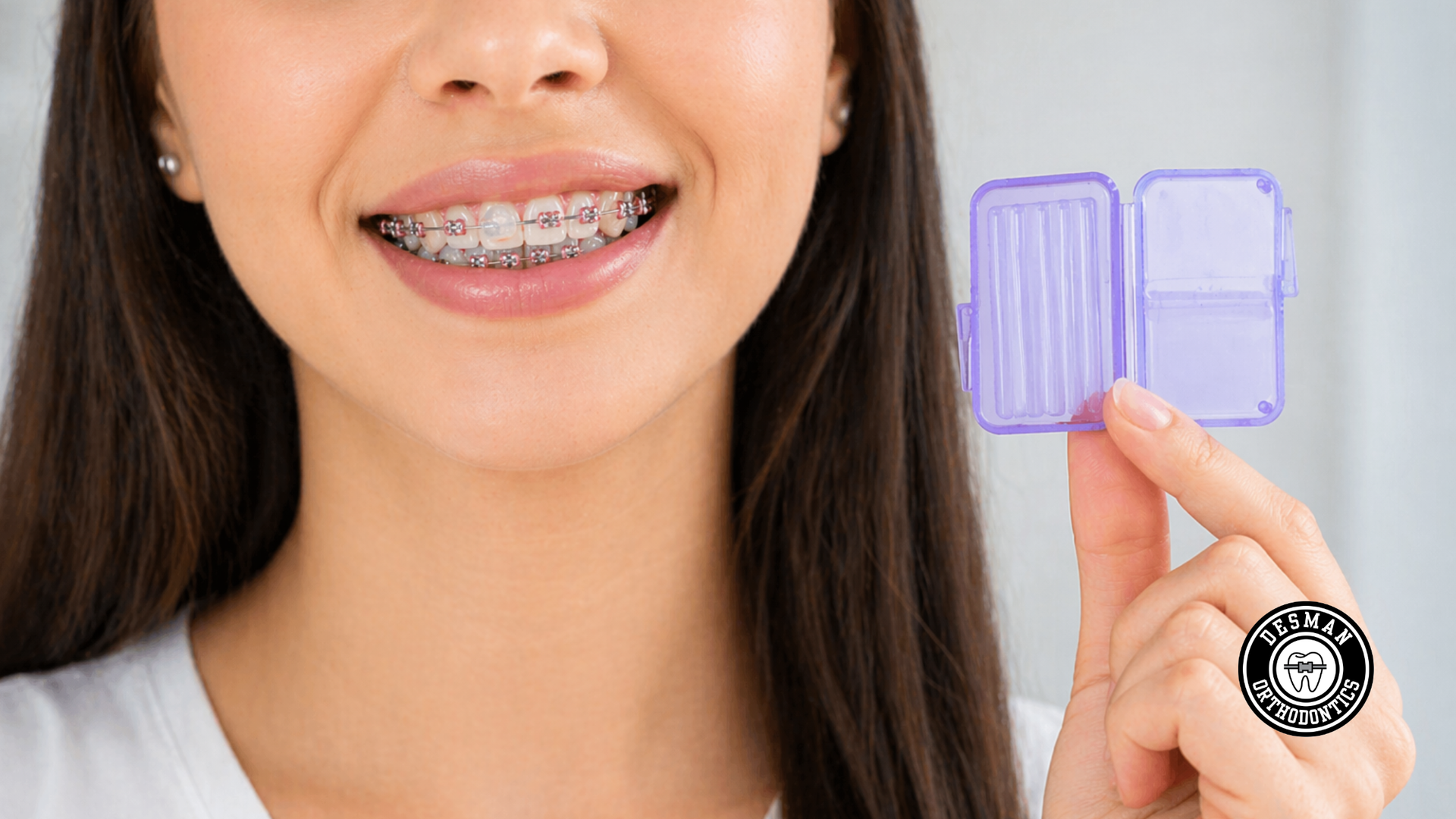 Woman smiling with braces, holding a purple dental aligner case beside her mouth.