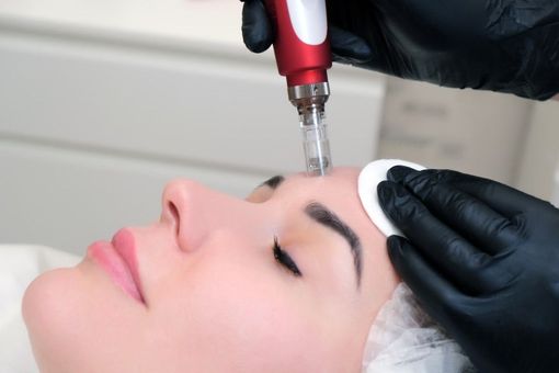 Trattamento viso Needling