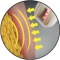 Migliora l’elasticità dei tessuti
