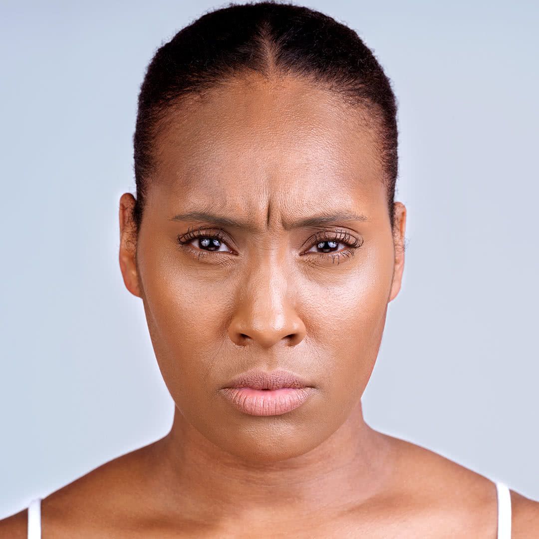 before Xeomin injections