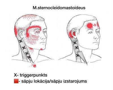trigerpunkti