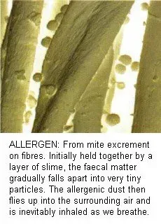 Allergies Southampton