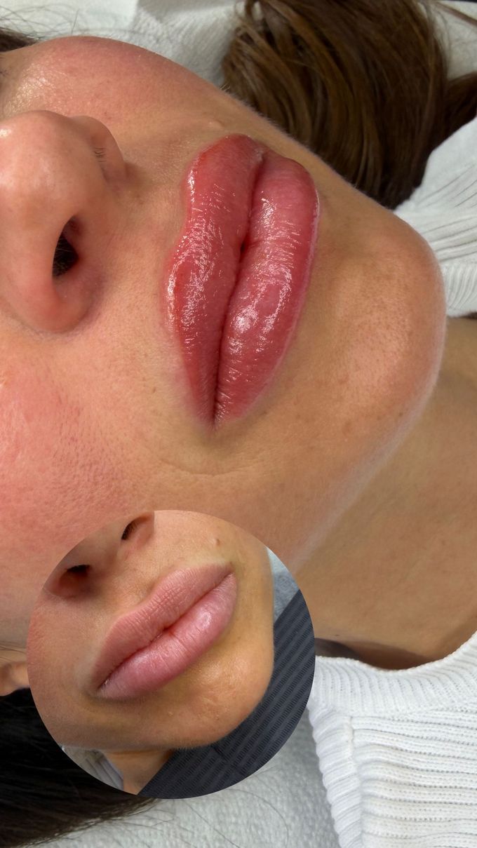Due foto: labbra con matita rossa/marrone tatuata e colore, una prima e una dopo l'applicazione del balsamo per le labbra.