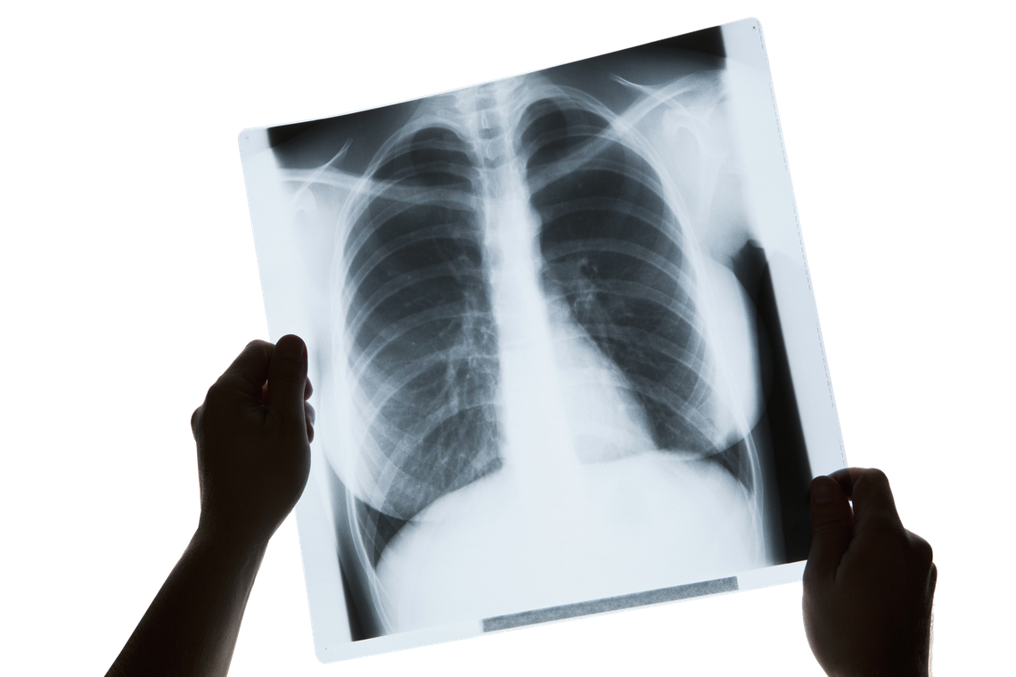 radiografie