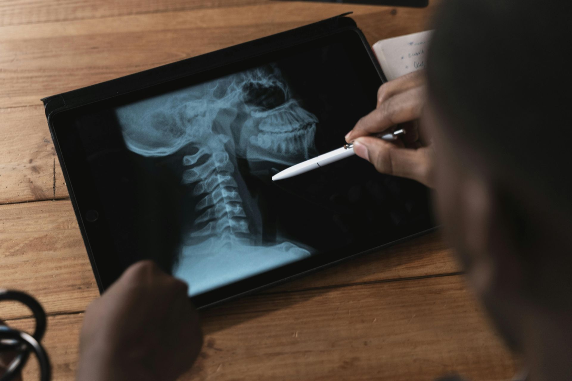 A person uses a stylus to point at a lateral cervical spine X-ray displayed on a tablet screen on a wooden desk.
