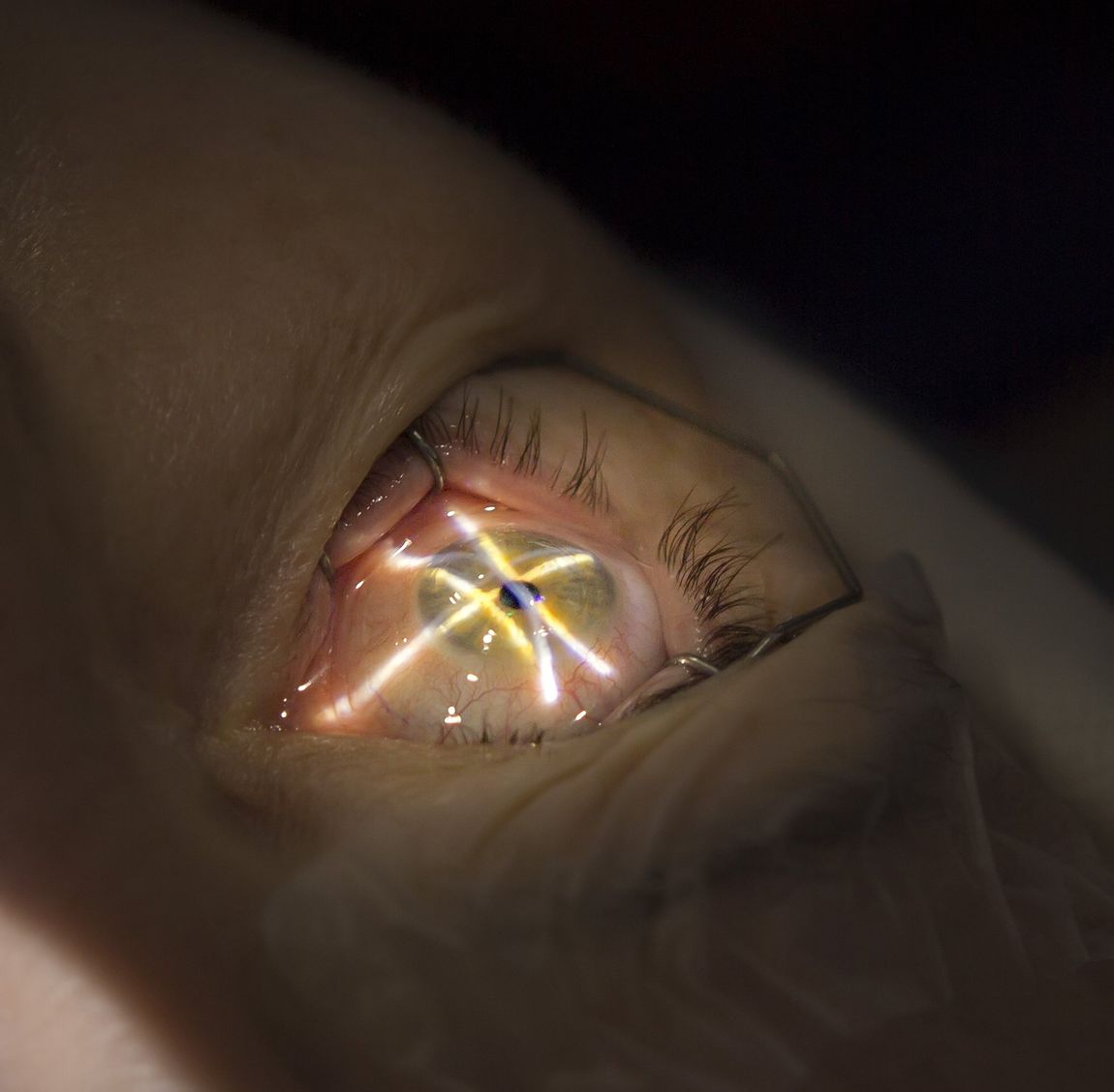 visita oculistica